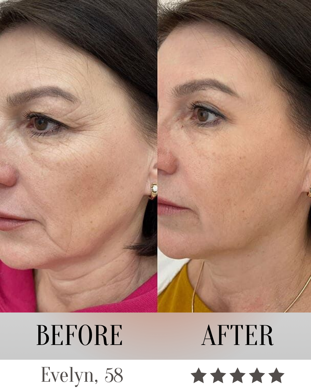 LumeliftPro 7-in-1 LED Face Mask