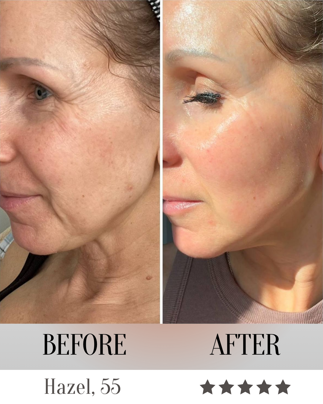 LumeliftPro 7-in-1 LED Face Mask