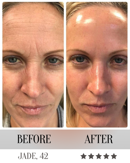LumeliftPro 3-in-1 LED Facial Sculptor