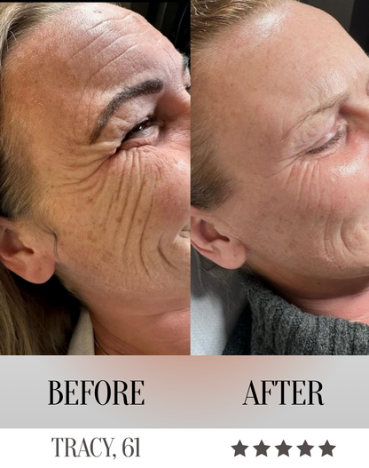 LumeliftPro 3-in-1 LED Facial Sculptor