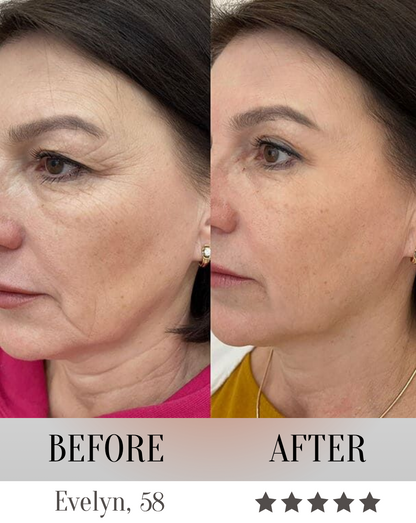LumeliftPro 7-in-1 LED Face Mask