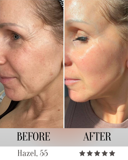 LumeliftPro 7-in-1 LED Face Mask