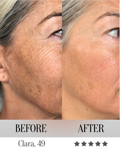 LumeliftPro 7-in-1 LED Face Mask